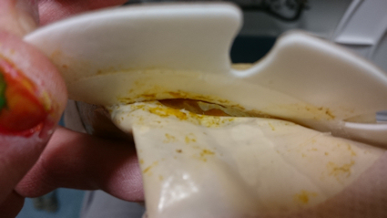 An image of hole in the seal holds the bag to the faceplate